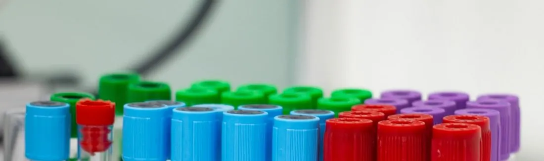 Sample tubes with coloured caps standing in a rack